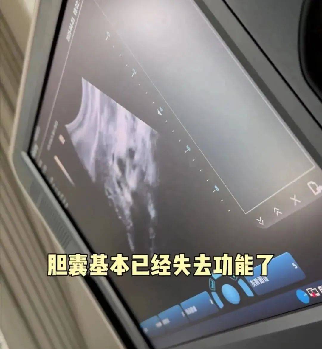 香港籃球投注_36岁知名女演员确诊香港籃球投注！“已基本失去功能”