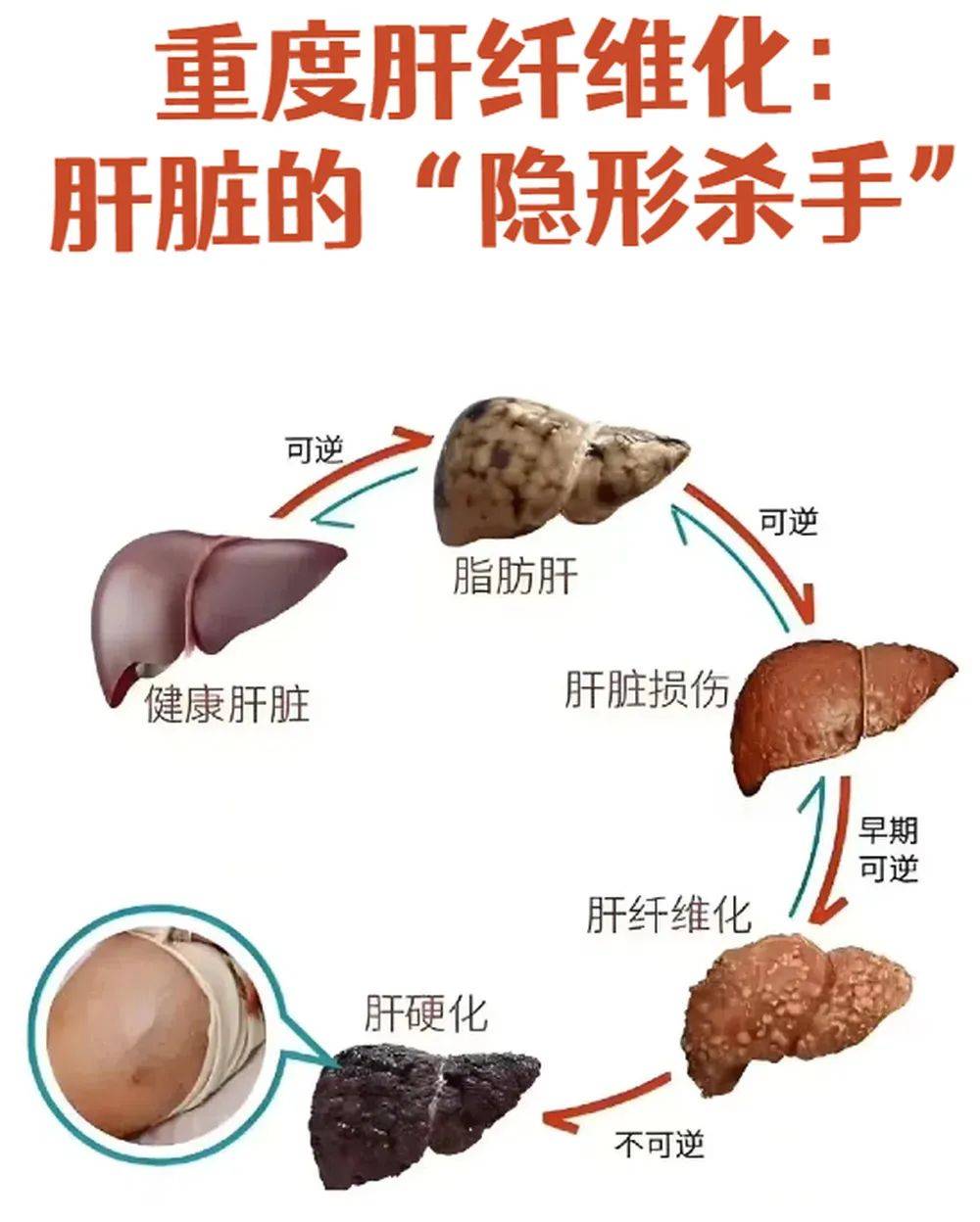 皇冠信用網登2代理
_山东网红“草帽姐”自曝患肝纤维化终生无法康复皇冠信用網登2代理
，劝粉丝不要经常生气，专家提醒